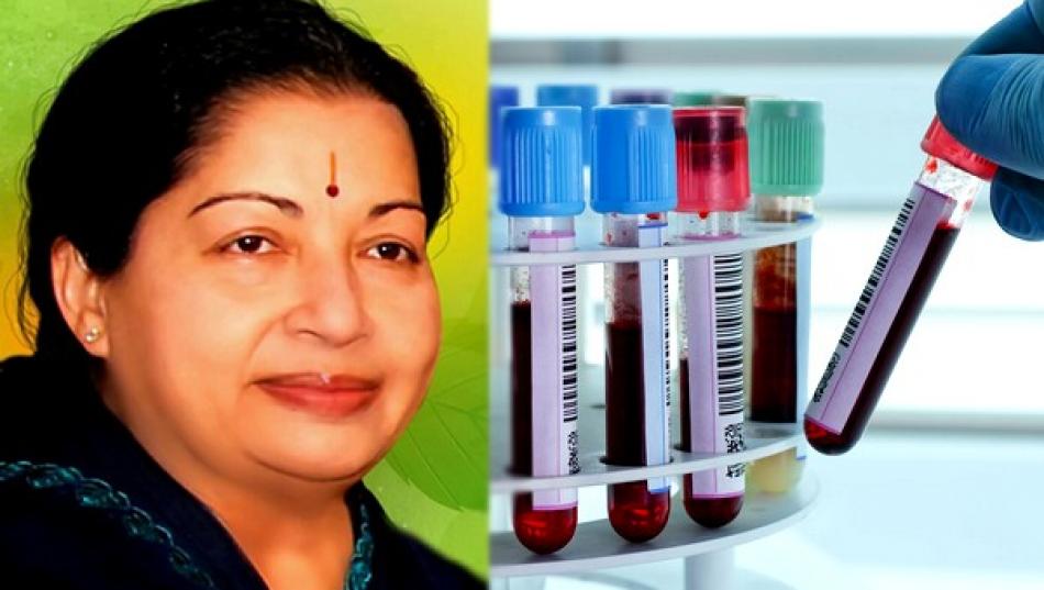 There is no DNA model of Jayalalithaa - Apollo statement to court